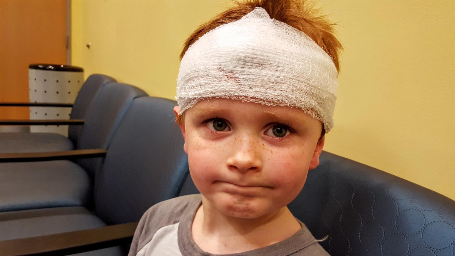 חבלות ראש בילדים