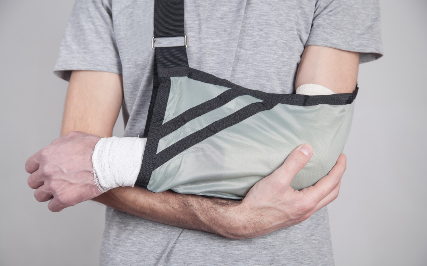 סימנים לשבר ביד