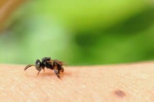 אלרגיה לדבורים עקיצה ראשונה