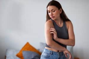 גירוד עקיצות יתושים