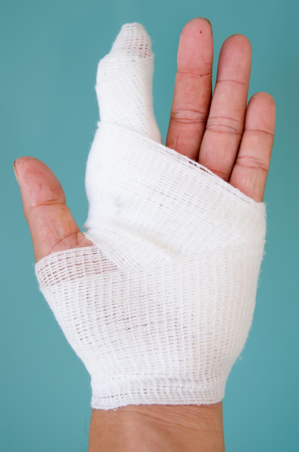 שבר באצבע ביד זמן החלמה