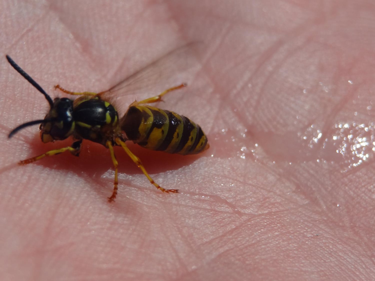תוך כמה זמן עוברת עקיצת דבורה